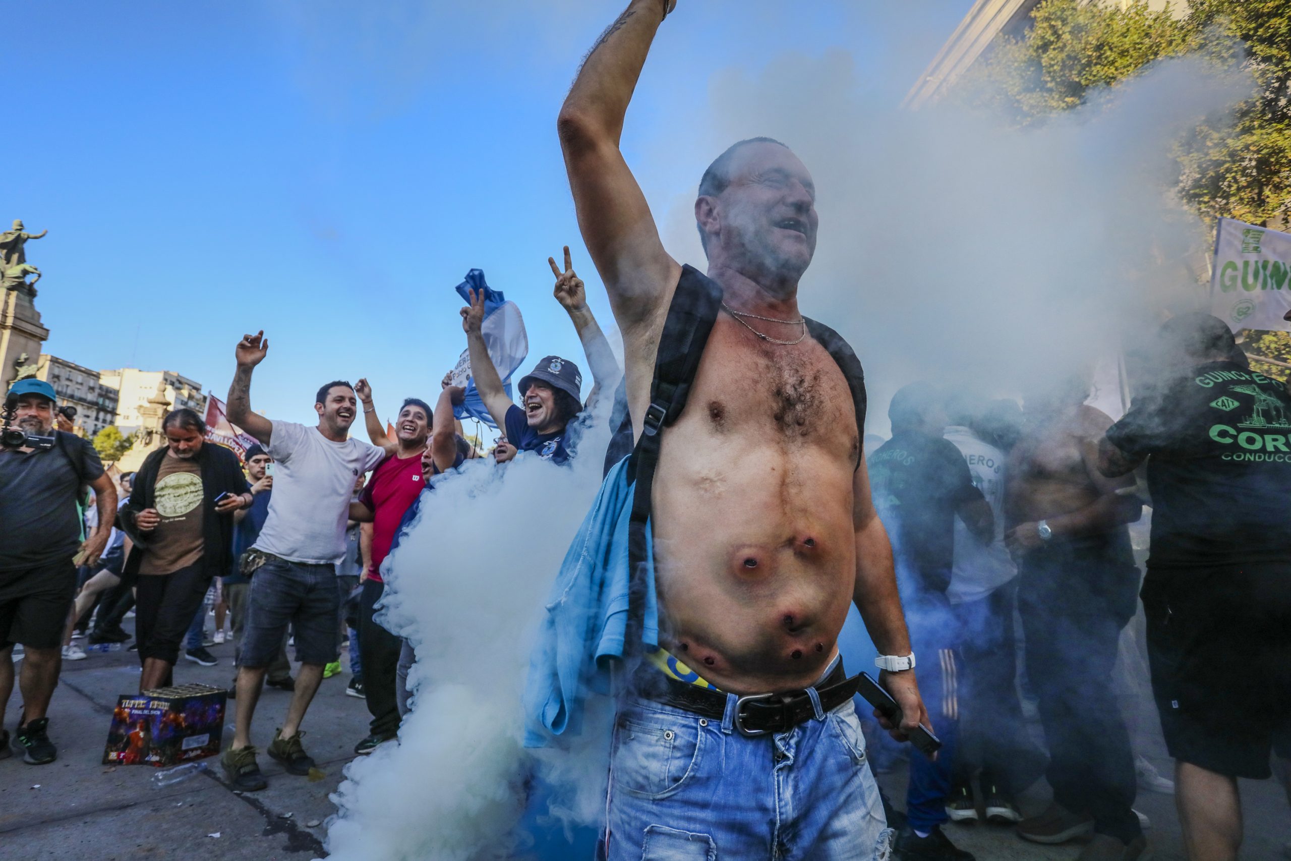Injured man with rubber bullet wounds during Peronist nostalgia Argentina demonstration